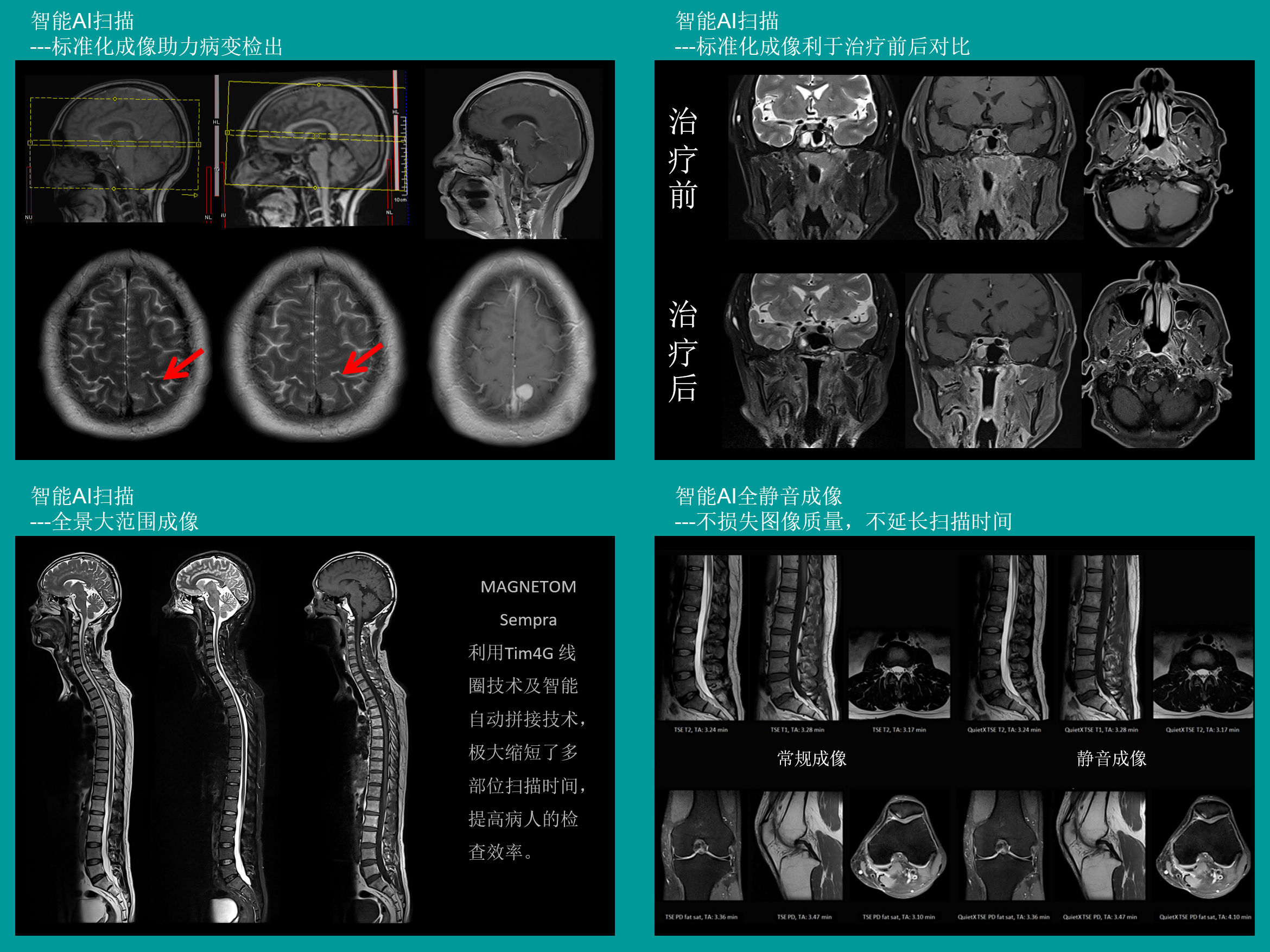 迅影门诊部核磁共振检查部位